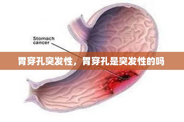 胃穿孔突发性,胃穿孔是突发性的吗