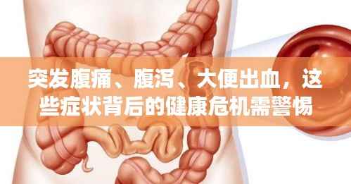 突发腹痛、腹泻、大便出血,这些症状背后的健康危机需警惕!