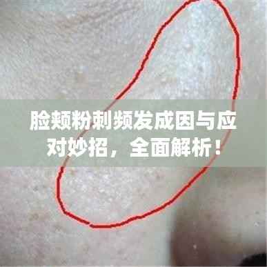 脸颊粉刺频发成因与应对妙招,全面解析!